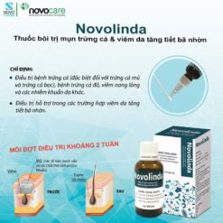 thuốc bôi Novolinda điều trị mụn trứng cá liệu trình 2 tuần